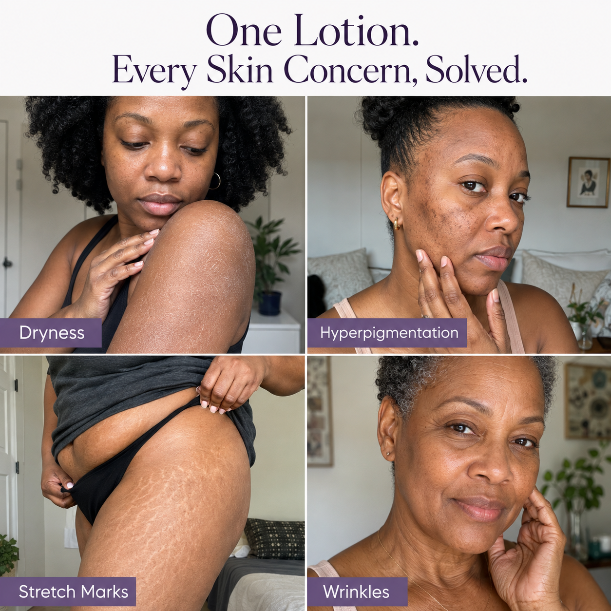 Mature Melanin™ Face + Body Renewal Lotion
