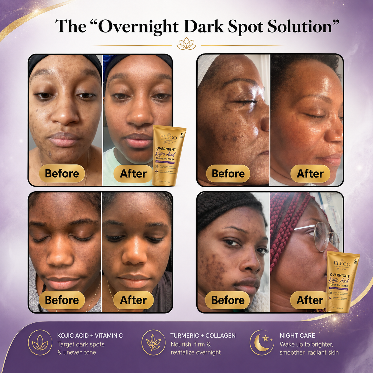 Original: Overnight Kojic Acid Turmeric Mask
