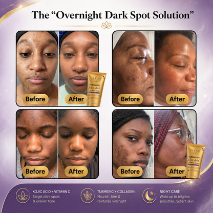 Original: Overnight Kojic Acid Turmeric Mask